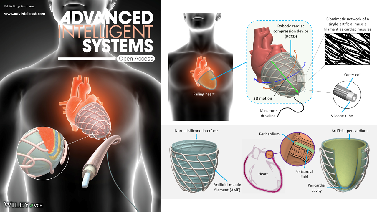 Robotic cardiac compression device
