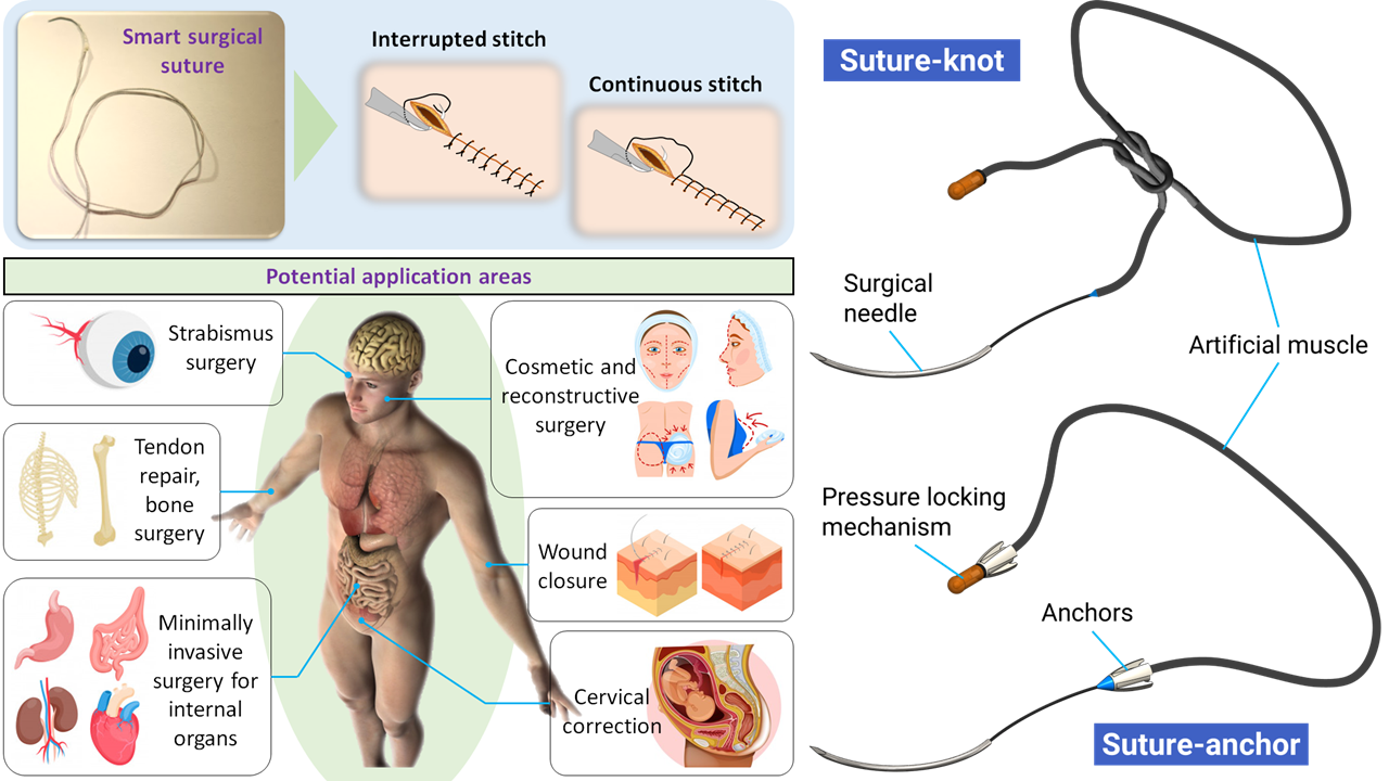 Smart surgical sutures using soft artificial muscles