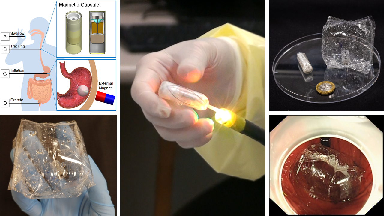 Magnetically actuated swallowable capsule for weight management